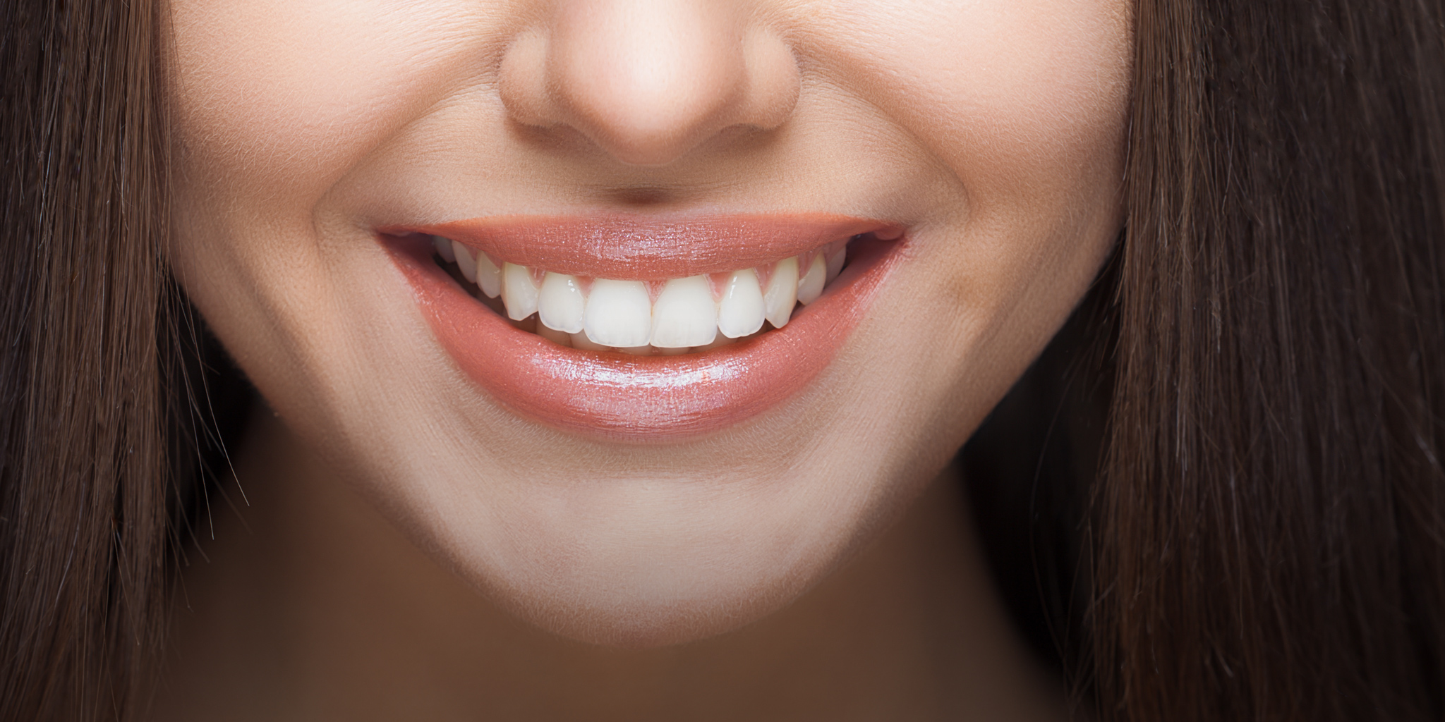 Weiße Zähne durch Bleaching – sanfte Zahnaufhellung